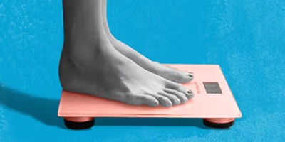 Scale